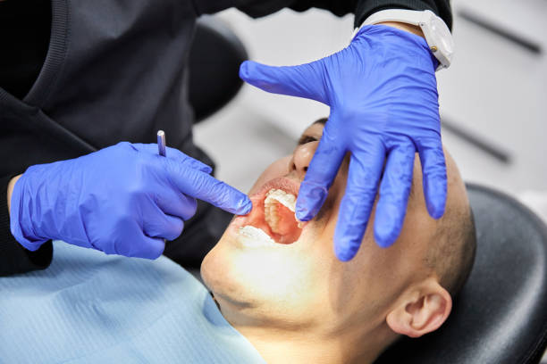 Best Emergency Wisdom Tooth Extraction in Dasher, GA